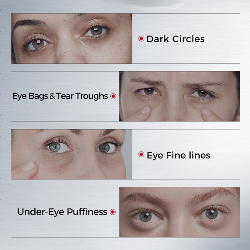 Eye Patches for Dark Circles – - đánh giá và giá Collagen Eye Patch